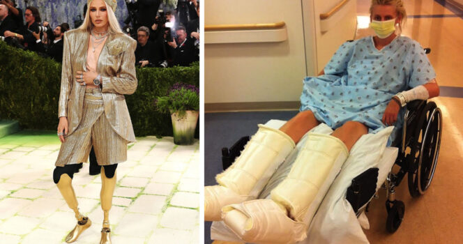 Model with “golden legs” has scary tampon warning after losing both limbs aged 24