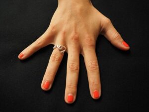 Doctor Uncovers A Telltale Sign In Your Fingernails That May Predict Your Life Expectancy