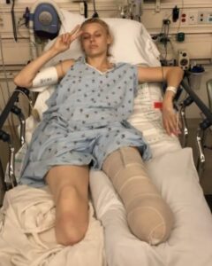 Her legs are amputated after using a common household product