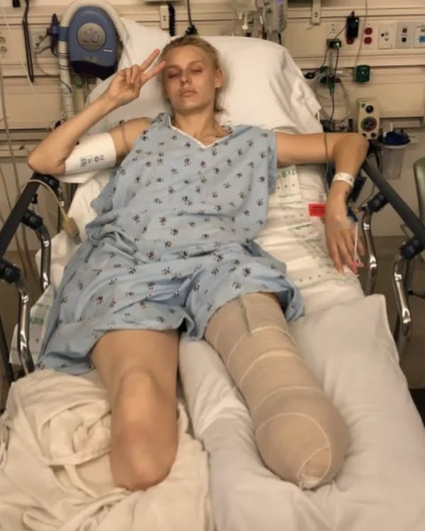 Her legs are amputated after using a common household product