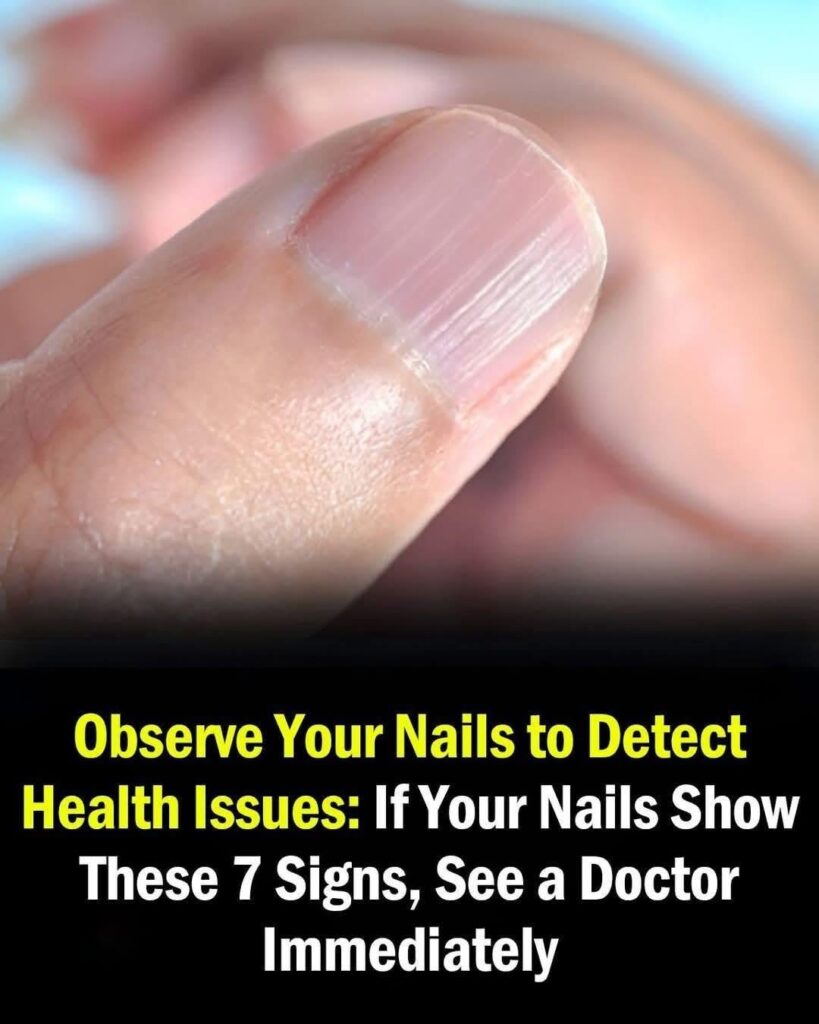 Doctor reveals health issues hidden in your nails