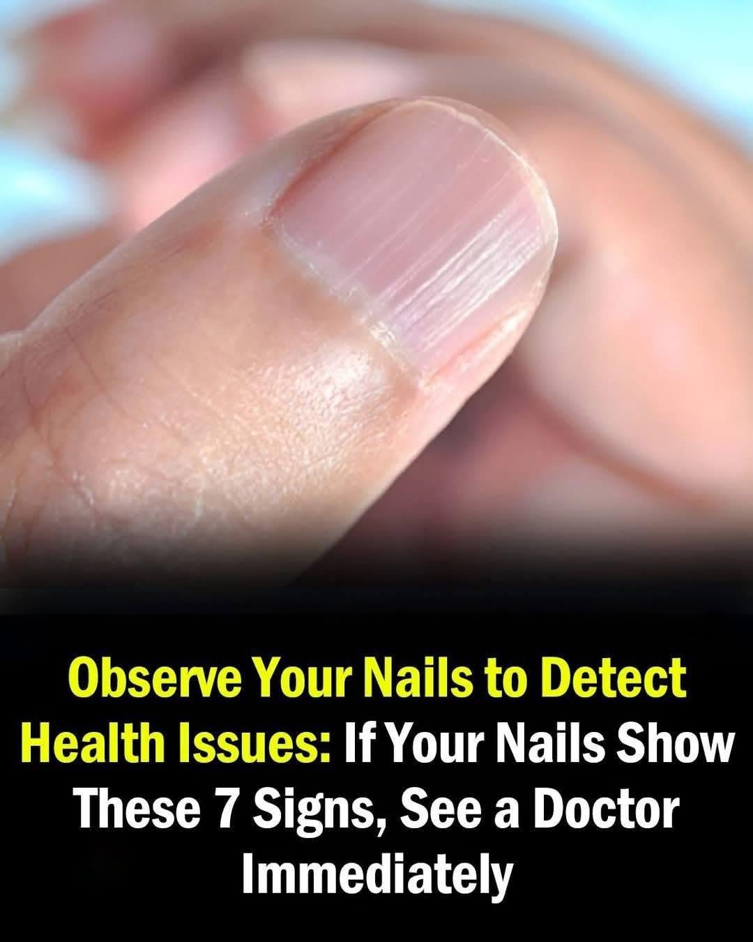 Doctor reveals health issues hidden in your nails