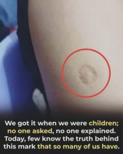 What the small round scar on your arm might indicate That Small Round Scar on Your Upper Arm Might Be Carrying a Piece of History