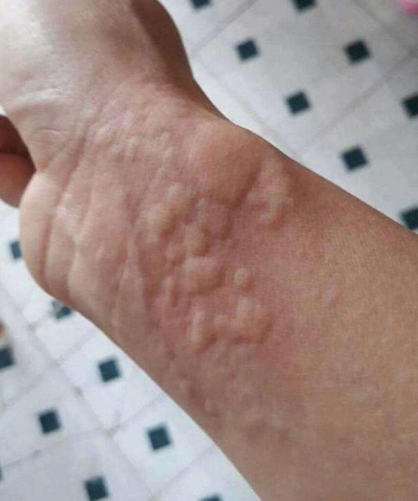 These are the consequences of sleeping with…