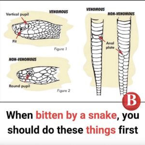 Snake bite signs and first aid you need to know