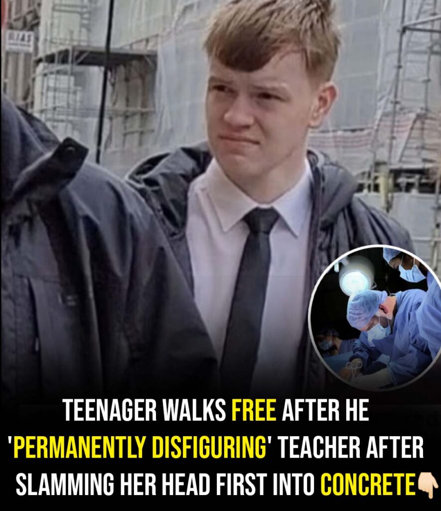 Teen who disfigures teacher avoids jail