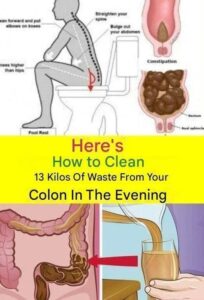 Important Health Clarification: “Clean 15kg of Waste from Your Colon Overnight” Is Not Scientifically Possible