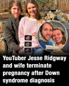 YouTuber Jesse Ridgway and wife terminate pregnancy after Down syndrome diagnosis