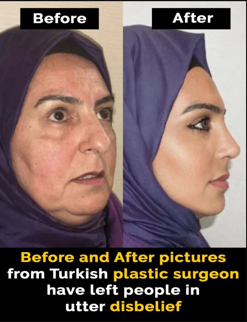 Plastic surgeon’s cosmetic work leaves people in disbelief