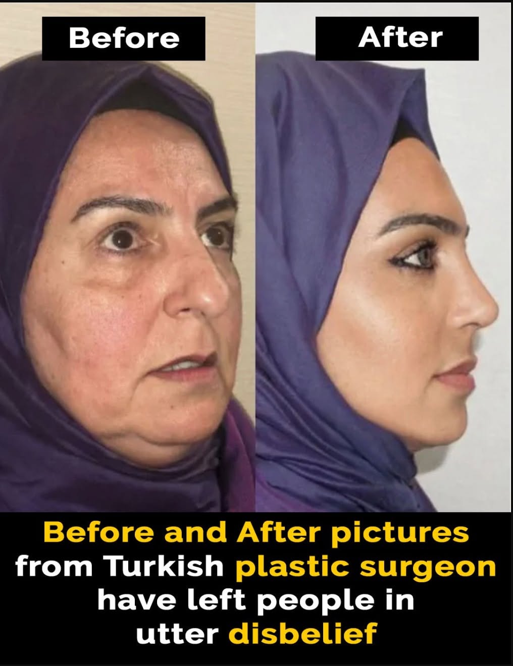 Plastic surgeon’s cosmetic work leaves people in disbelief