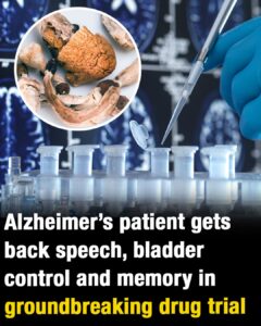 Alzheimer’s patient recovers speech and memories in groundbreaking drug trial