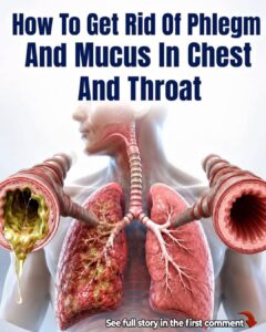 8 Ways To Get Rid Of Phlegm And Mucus In Chest And Throat