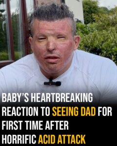 Baby’s heartbreaking reaction to seeing dad for first time after horrific acid attack