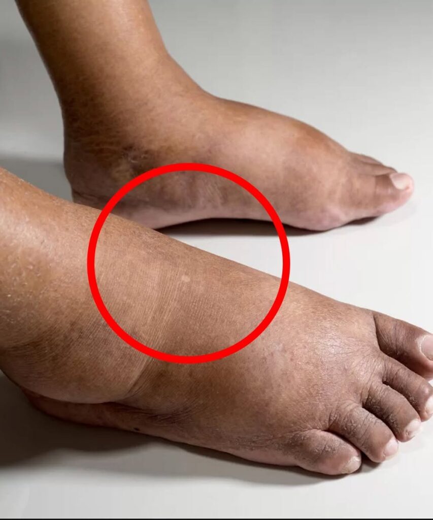 These are the consequences of sleeping with…