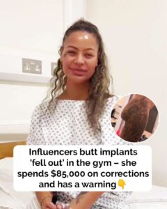 Influencer spends $85,000 on surgery after butt implants ‘fell out’