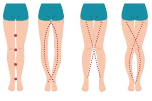 The Subtle Messages Hidden in a Woman’s Legs
