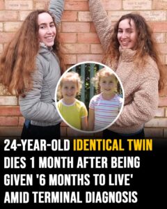 24-year-old identical twin dies 1 month after being given ‘6 months to live’ amid terminal diagnosis