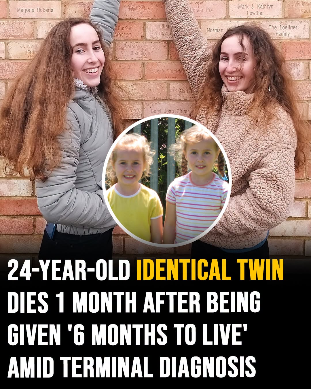 24-year-old identical twin dies 1 month after being given ‘6 months to live’ amid terminal diagnosis