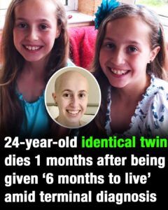 24-year-old identical twin dies 1 month after being given ‘6 months to live’ amid terminal diagnosis