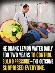 The Lemon Water Trap: Why One Man’s Two-Year Daily Habit Nearly Cost Him Everything