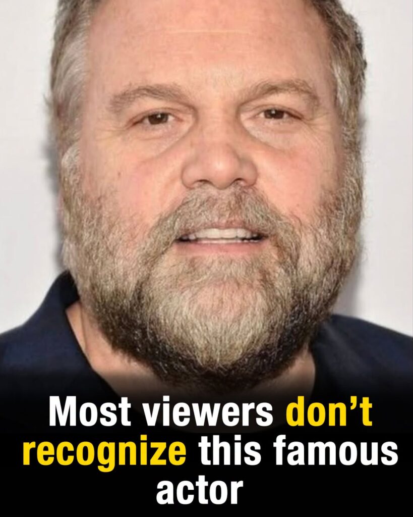 Women ran from Vincent D’Onofrio after break-through role