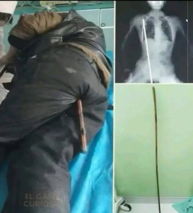 Young man hospitalized after being arrested….