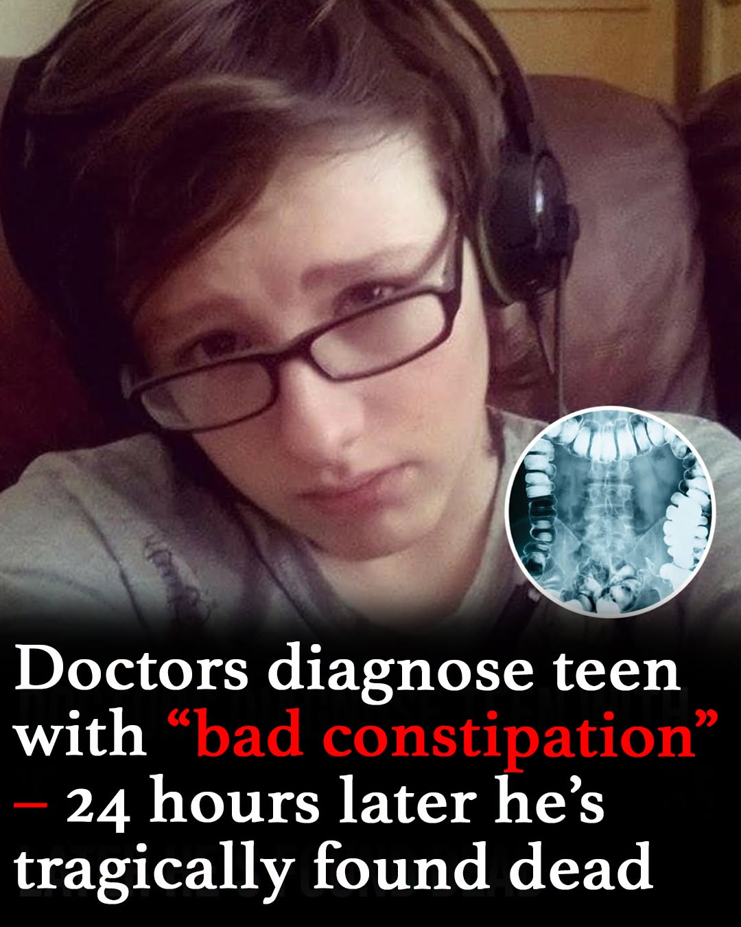 Doctors diagnose teen with constipation, dies 24 hours later