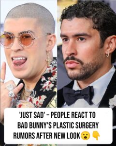 Bad Bunny sparks plastic surgery rumors after dramatic transformation at the Grammys