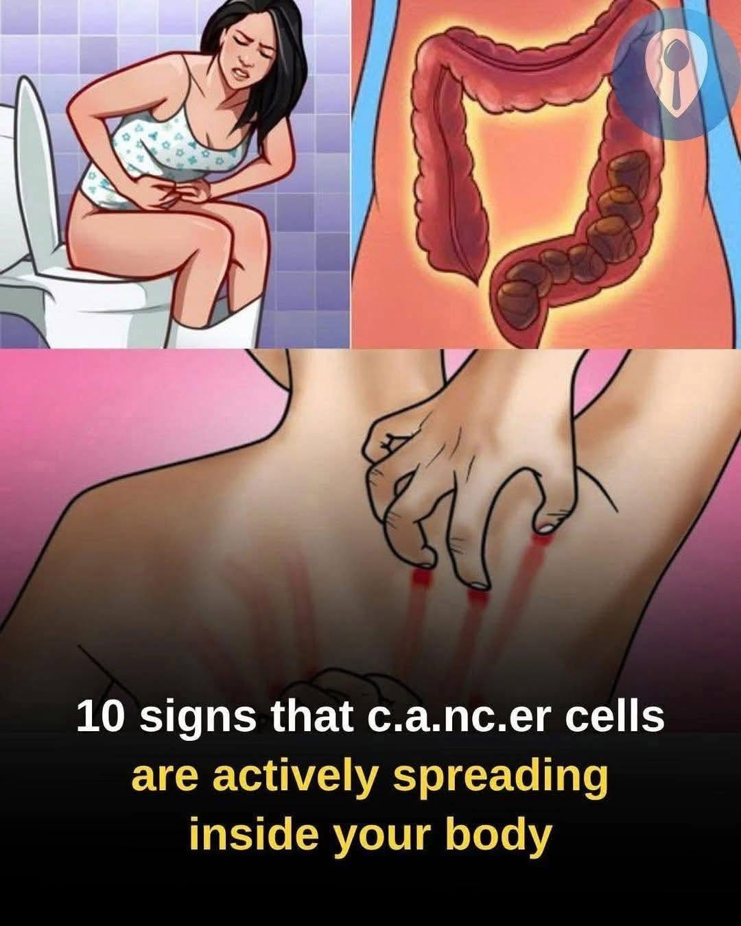10 warning signs of cancer developing in the body