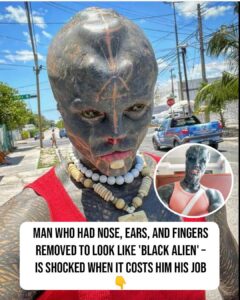 Man amputates body parts – his ‘Black Alien’ modifications cost him job