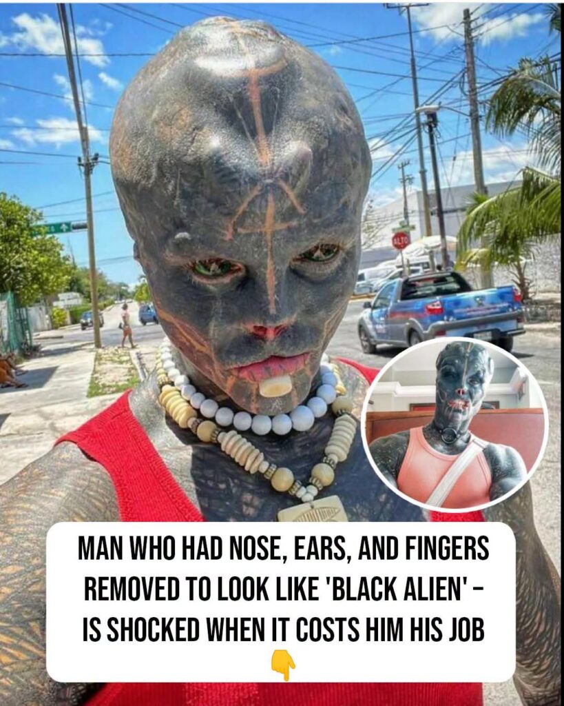 Man amputates body parts – his ‘Black Alien’ modifications cost him job