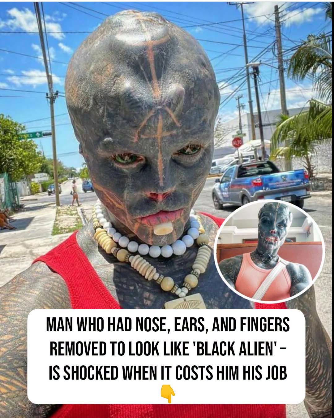 Man amputates body parts – his ‘Black Alien’ modifications cost him job