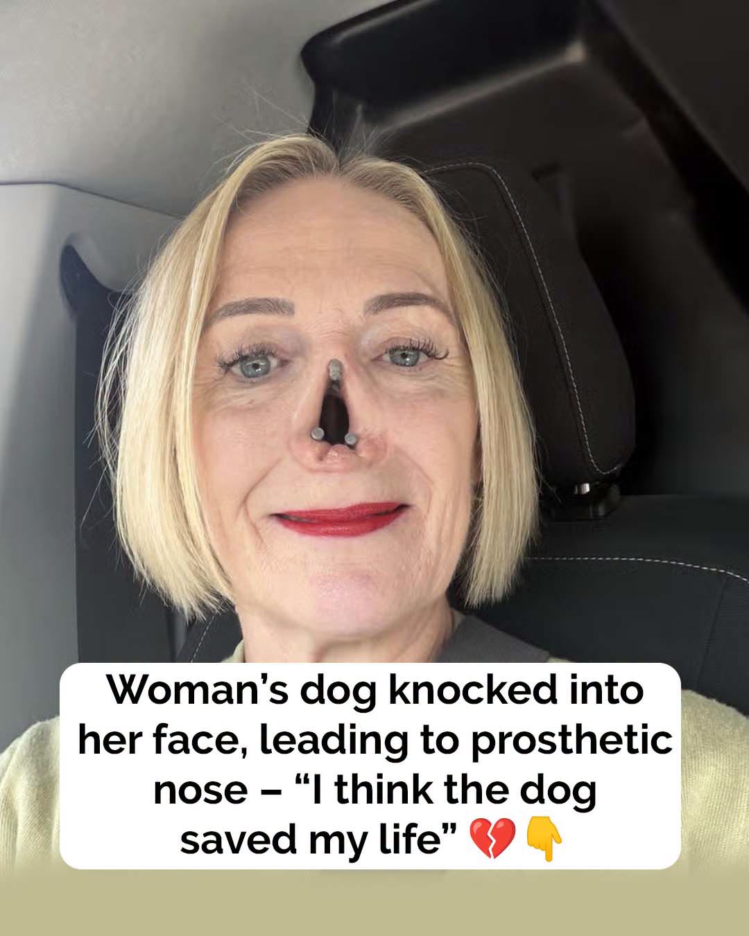 Woman’s dog alerted her to deadly disease which lead to her prosthetic nose