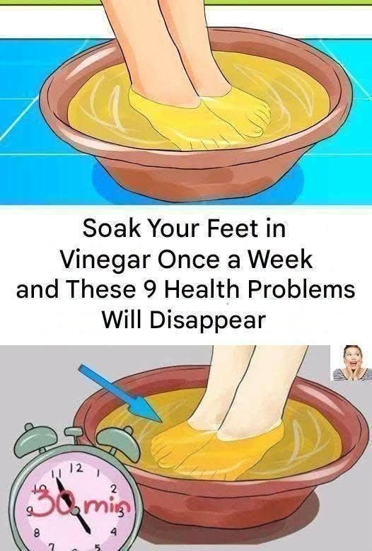 Weekly Vinegar Foot Soak