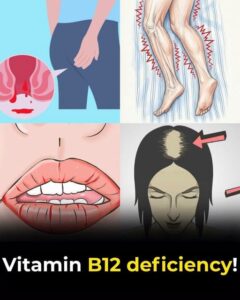 Common Signs of Low Vitamin B12
