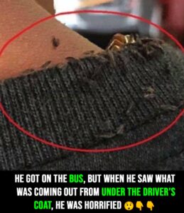 Man goes viral for extreme head lice infestation