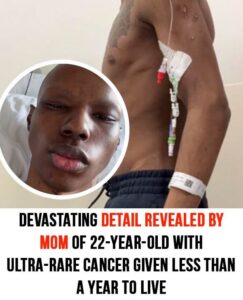 22-year-old told he has less than a year to live after stomach pain reveals ultra-rare cancer