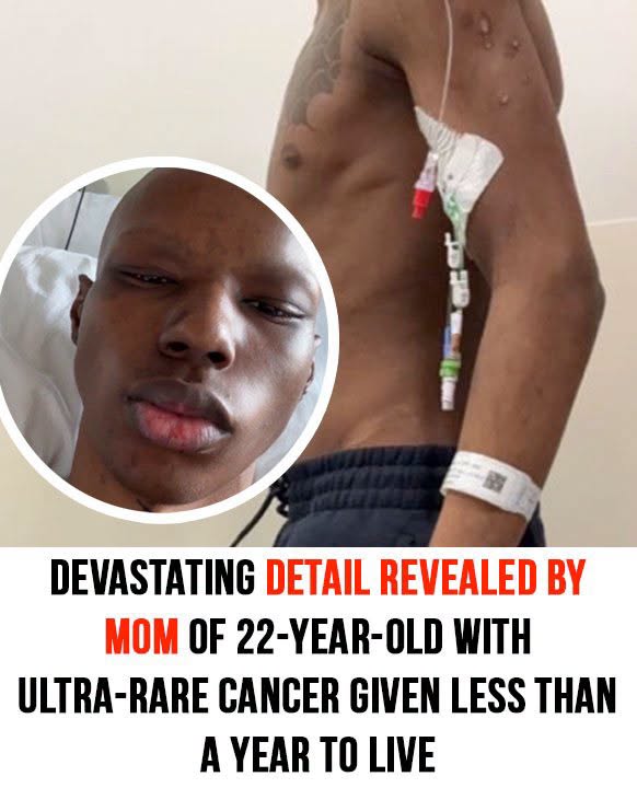 22-year-old told he has less than a year to live after stomach pain reveals ultra-rare cancer