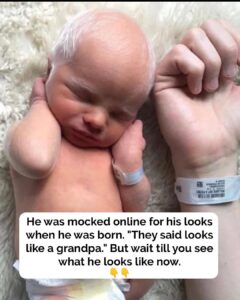 Albino baby mocked for white hair is happy and healthy years later
