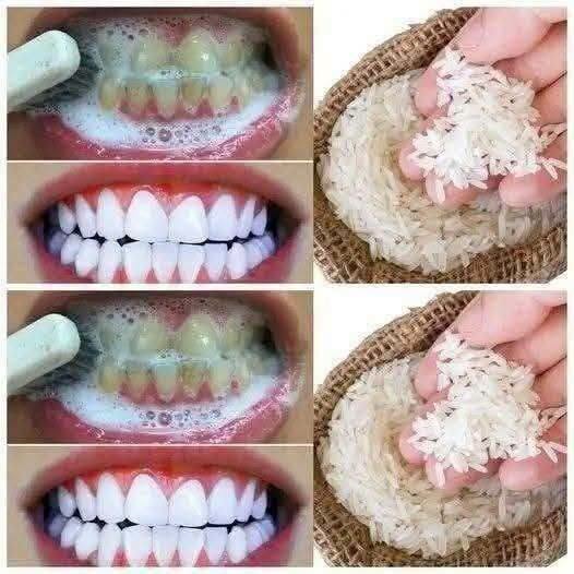 A way to whiten your teeth in just 1 minute that no dentist will tell you..