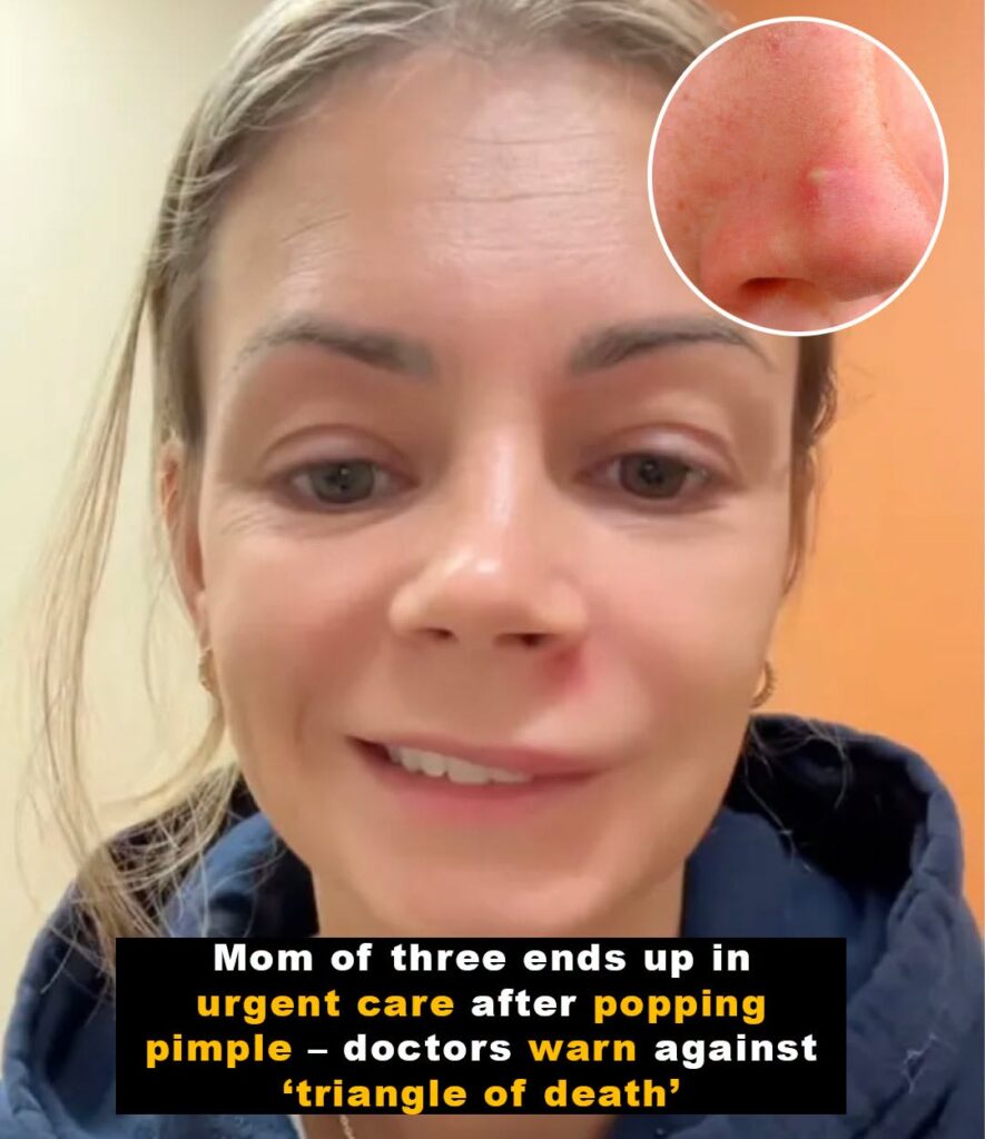 Doctors warn of popping pimple in ‘triangle of death’