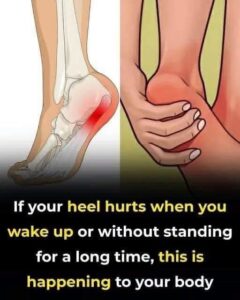 7 effective exercises to reduce heel pain and manage plantar fasciitis naturally