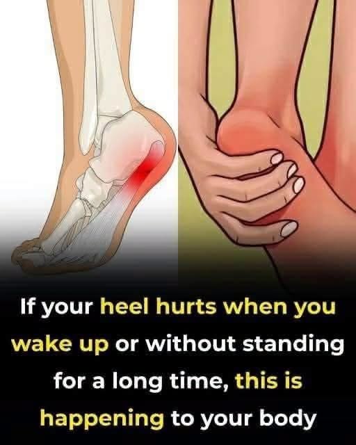 7 effective exercises to reduce heel pain and manage plantar fasciitis naturally
