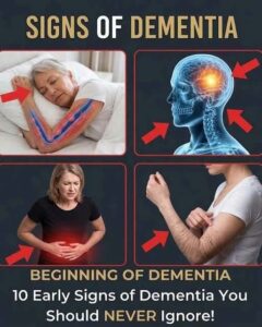 10 Signs of Dementia You Should Never Ignore