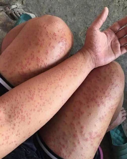 I Stayed at My Friend’s Old Apartment for a Few Days Then I Noticed These Strange Bumps