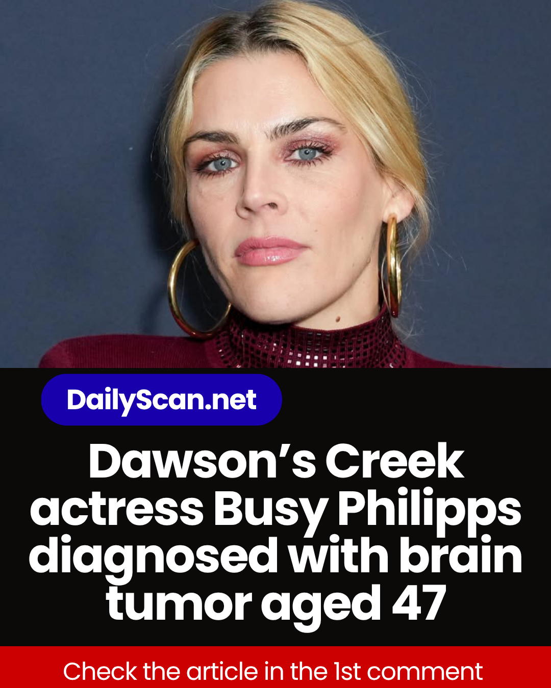 Dawson’s Creek actress Busy Philipps diagnosed with brain tumor aged 47