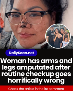 Woman has arms and legs amputated after routine checkup goes horrifically wrong