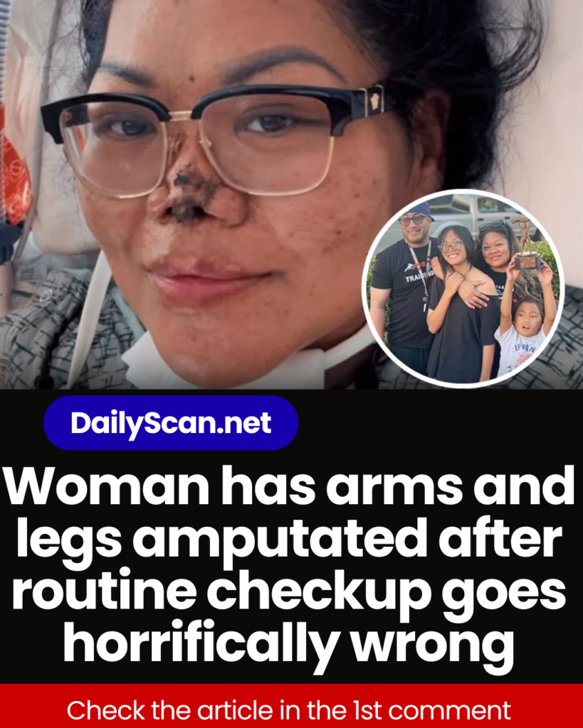 Woman has arms and legs amputated after routine checkup goes horrifically wrong