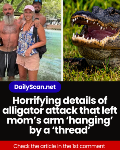 Horrifying details of alligator attack that left mom’s arm ‘hanging’ by a ‘thread’