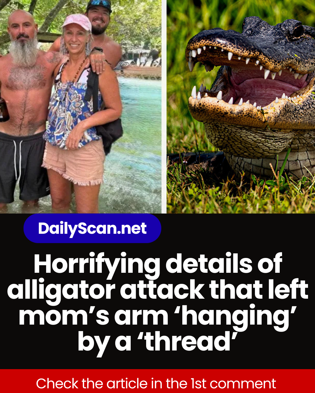 Horrifying details of alligator attack that left mom’s arm ‘hanging’ by a ‘thread’